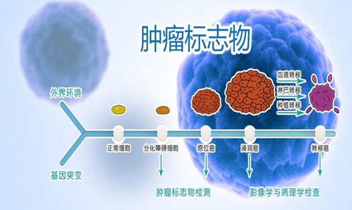肿瘤标志物全知道：49 种肿瘤标志物深度解读